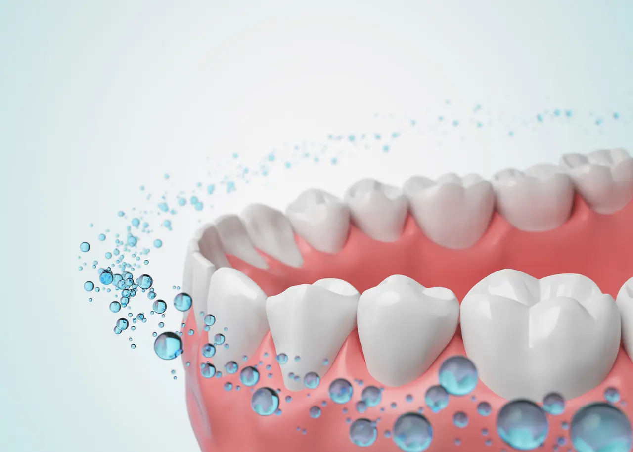 Fluoride Treatment